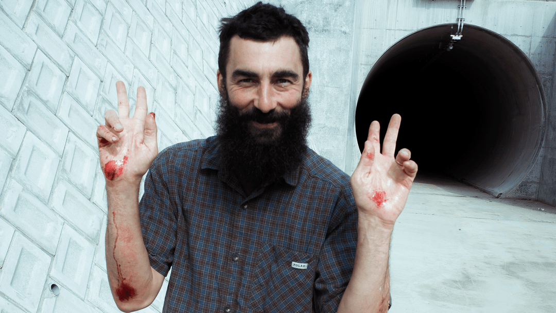 “It was the gnarliest road rash I’ve ever gotten” – backstories with Nick Boserio